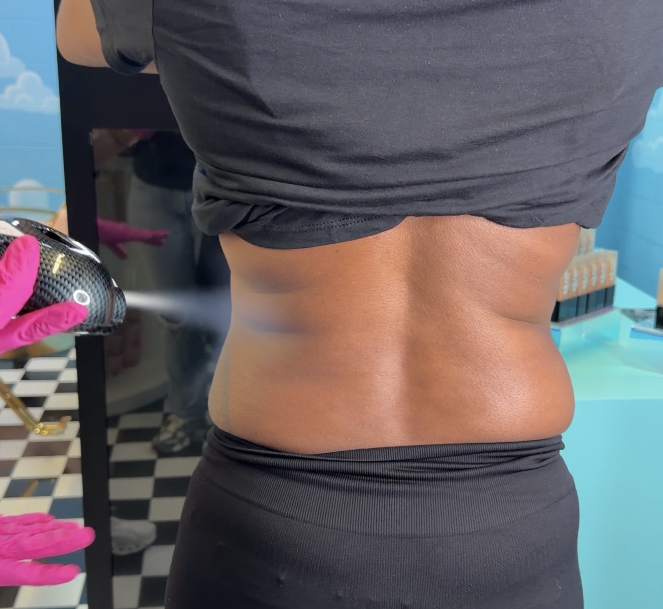 Localized Cryotherapy