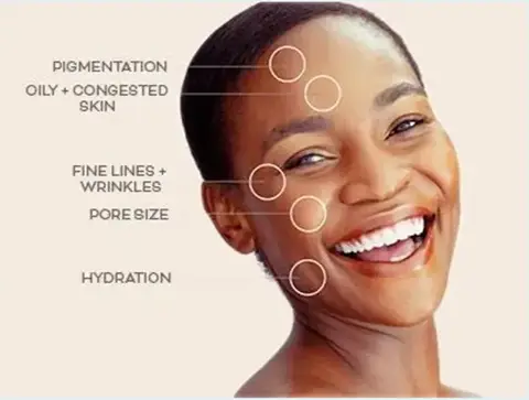 Cryofacial + Hydrofacial Snellville GA Cryofacial